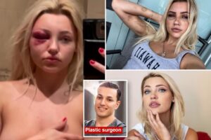 Exclusive | Model savagely beaten, turned into ‘sex slave’ by sicko NYC plastic surgeon — who performed procedure without anesthesia to cover up his abuse: lawsuit