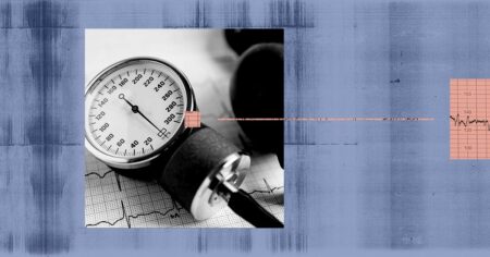 Can arm position affect blood pressure readings?