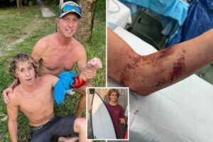 Teen surfer mauled by shark in Florida: ‘I could have lost my arm’