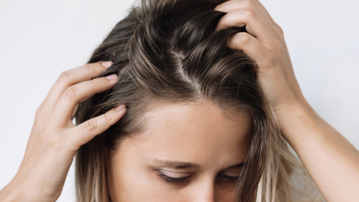 Close-up photo of a woman's scalp