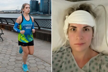 I had brain surgery in January, now I’m running the NYC marathon