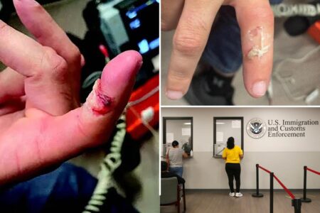 Suspected Russian terrorist bit ICE officer’s finger during arrest in downtown LA