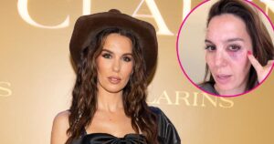 Christy Carlson Romano Claims She Was ‘Shot in the Eye’ During Husband’s Birthday Celebration