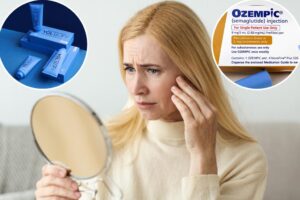 Weight loss skincare is on the way: New antiaging treatment was designed to battle ‘Ozempic face’