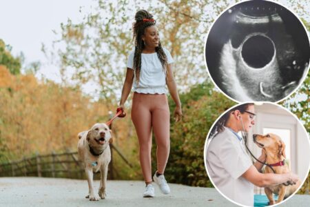 Veterinarian warns against seemingly harmless activity with your dog — after massive parasite was found in woman’s pelvis