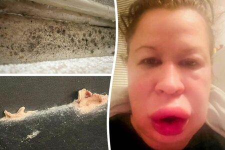 Mom suffers horrific allergic reaction to moldy home so damp mushrooms grew on the furniture
