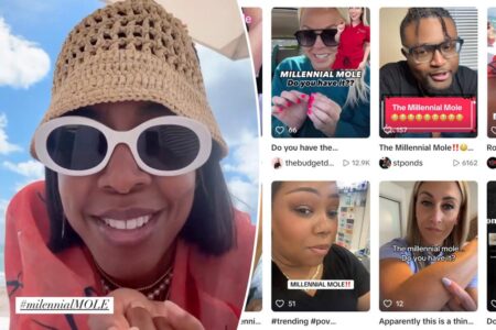 Is the ‘millennial mole’ real? Generation makes strange claim they all have the same mysterious beauty mark