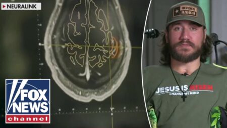 ‘INCREDIBLE PRIVILEGE’: First Neuralink patient speaks out about brain implant