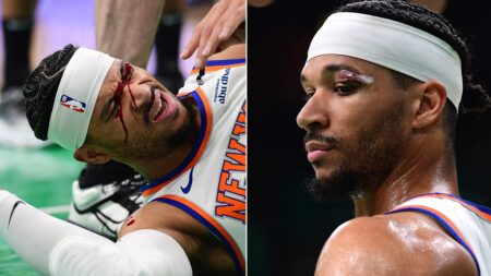 Knicks’ Josh Hart suffers bloody cut over eye in team’s loss to Celtics