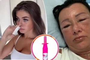Viral ‘Barbie drug’ that can help you tan can cause brain swelling, erection problems and even cancer, experts warn
