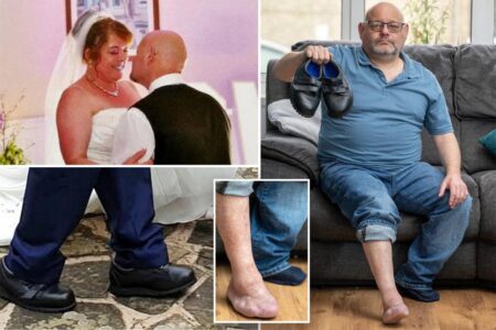 My shoes were too tight on the day I got married— then they had to amputate my toes