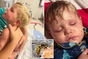 Georgia toddler fighting for life after being stung over 150 times by wasps