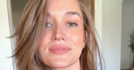 Bachelor Nation Alum Jade Roper Says She Has Benign Pilar Cyst on Scalp, Debates Removal