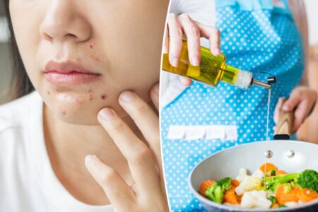 A common cooking mistake could be making you break out — it has nothing to do with your diet