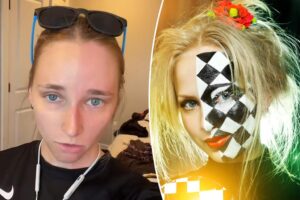 I have ‘Harlequin sign’ — only half of my face sweats and gets red from exercise