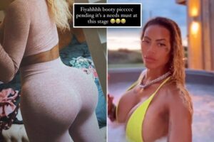 ‘Model’ traveled to another country to get butt implants — and they fell out: ‘I felt something come out’