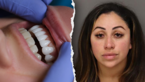 Florida woman arrested for unlicensed dental work allegedly used superglue on victims’ teeth: police