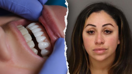 Florida woman arrested for unlicensed dental work allegedly used superglue on victims’ teeth: police