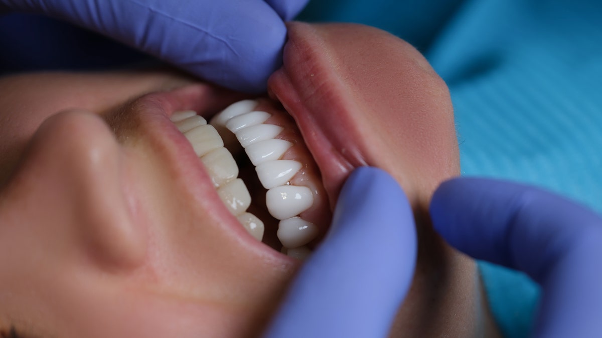 Dental work should be performed by licensed technicians.