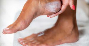 Dry, Cracked Feet? Even Nurses Approve of This  Hydrating Cream That Buffs Imperfections