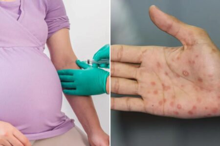 Three babies die amid ‘concerning rise’ of syphilis in New York — what to know about the dangerous disease