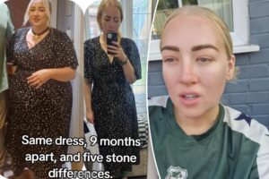 I lost 84 pounds taking Mounjaro — now I feel disgusting when I look at my naked body