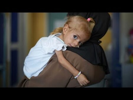 Gaza toddler evacuated to Italy shows signs of recovery from rare disease and severe malnutrition