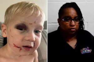 Georgia day care worker who allegedly beat 1-year-old boy black and blue released on bail