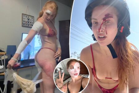Sexy reality star sparks backlash for filming motorbike crash aftermath — while wearing a bikini: ‘What are you trying to prove?’