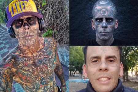 I had tattoos on 95% of my body — now I’m having them removed, and the pain is horrible