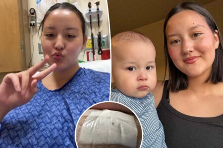 Mom goes to ER after her son bit off half her nipple while breastfeeding