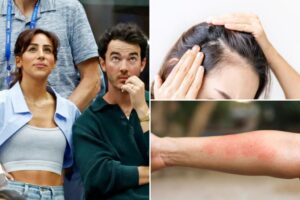 Kevin Jonas’ wife Danielle Jonas was diagnosed with Lyme disease after experiencing this ‘very traumatic’ symptom