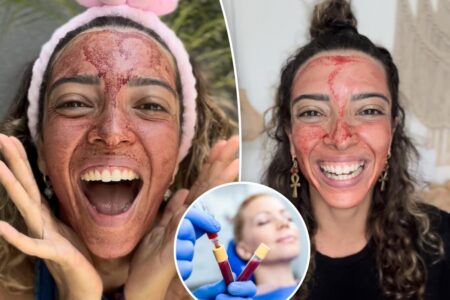 Beauty influencers are encouraging skincare enthusiasts to save their menstrual blood for a bizarre purpose Beauty influencers are encouraging skincare enthusiasts to save their menstrual blood for a bizarre purpose