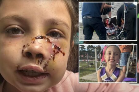 Alabama girl, 9, mauled by dog that ‘grabbed’ her face, leaving brutal injuries Alabama girl, 9, mauled by dog that ‘grabbed’ her face, leaving brutal injuries