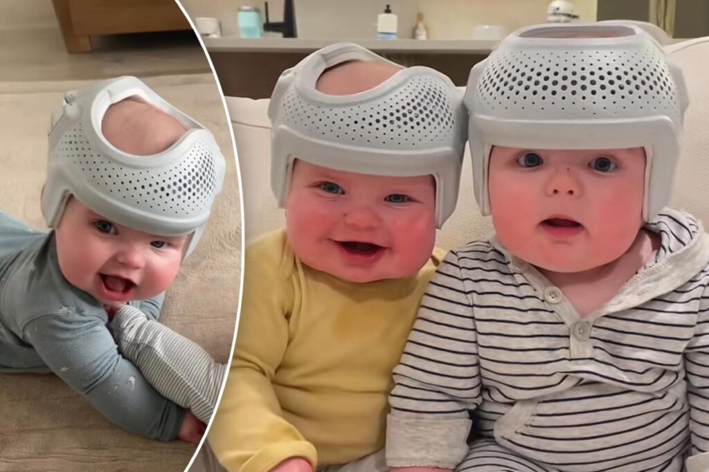 My twin babies wear 0 helmets for 23 hours a day to reshape their flat heads — haters say I’m ‘crazy,’ but it’s for their own good My twin babies wear 0 helmets for 23 hours a day to reshape their flat heads — haters say I’m ‘crazy,’ but it’s for their own good