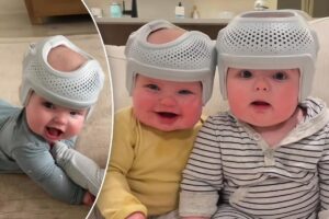 My twin babies wear 0 helmets for 23 hours a day to reshape their flat heads — haters say I’m ‘crazy,’ but it’s for their own good