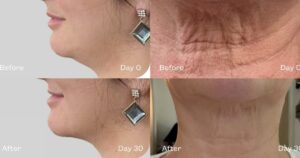 Sagging Jowls? This ‘Magic’ Serum Sculpts the Jaw and Lifts the Neck in Days