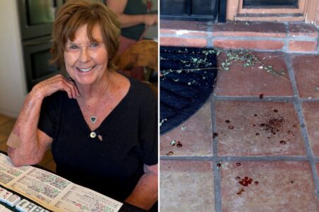 DNA splatter reveals Nancy Guthrie was bleeding from ‘either the hands or face,’ expert says