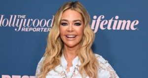 Denise Richards’ Plastic Surgeon Shares Facelift Surgery Details, What He Did for Her ‘Sexier’ Look
