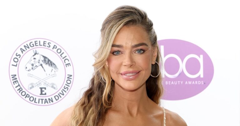 Denise Richards Shares Eye-Popping Before-and-After Facelift Photos: ‘Her Golden Face Is Hers Again’ Denise Richards Shares Eye-Popping Before-and-After Facelift Photos: ‘Her Golden Face Is Hers Again’