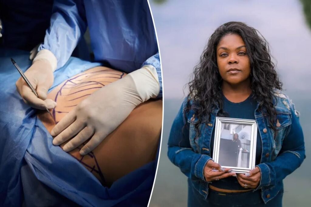 Disfiguring injuries and deaths at California cosmetic surgery chains prompt warnings from medical group