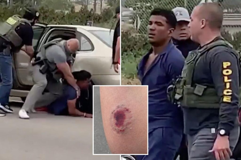 Vile photo shows gruesome bite mark on ICE officer after alleged Tren de Aragua gangster attacked him Vile photo shows gruesome bite mark on ICE officer after alleged Tren de Aragua gangster attacked him