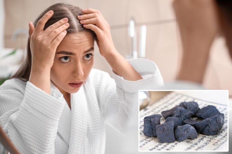 Ancient Chinese ‘hair blackening’ herb may fight balding naturally Ancient Chinese ‘hair blackening’ herb may fight balding naturally