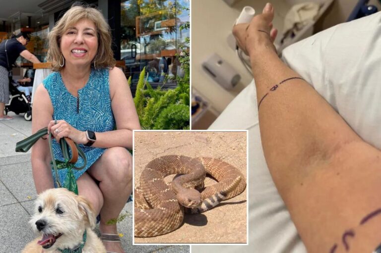 Grisly pictures show aftermath of rattlesnake bite — as victim speaks out