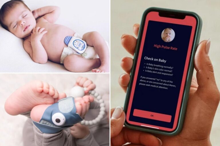 Does your baby need a high-tech wearable health tracker? Does your baby need a high-tech wearable health tracker?