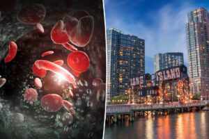 Long Island has a ‘high burden’ for a common blood disorder: new study