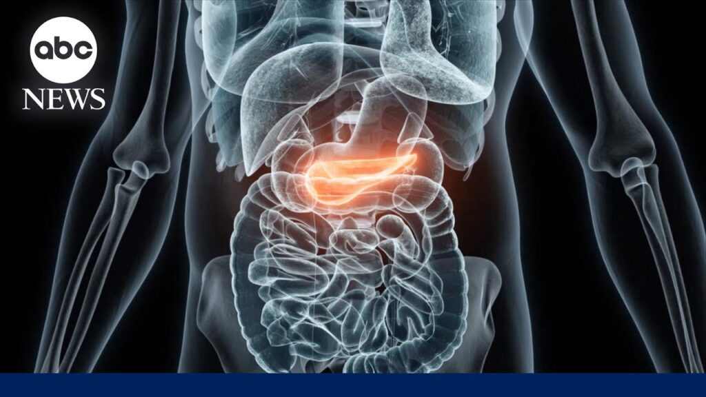 How a new drug could lengthen lives of pancreatic cancer patients