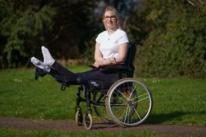 21-year-old to have legs amputated after legs locked straight, bent backwards