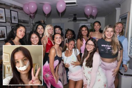Inside the plastic surgery parties young people are throwing to celebrate boob jobs and rhinoplasty: ‘New nose who dis?