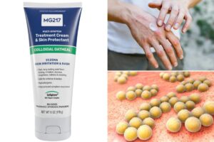 Skin cream sold on Amazon recalled over deadly bacteria risk